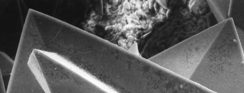 Oxalate toxicity - Oxalate Crystals by Kempf EK